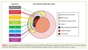 図7　心筋梗塞に伴う左室心筋の変化とMRIシークエンスのまとめ　　 文献[8]　より引用